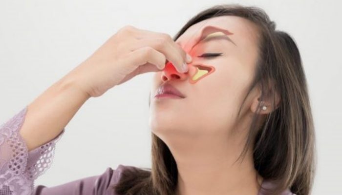 Giải pháp điều trị dành cho người bị bệnh viêm mũi dị ứng 